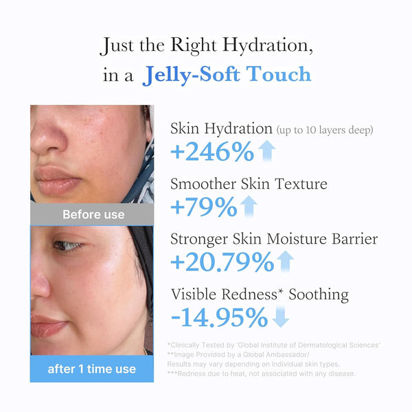 Medicube Jelly Hydration Daily Cream